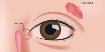 Tear Duct Surgery (Watery Eyes)