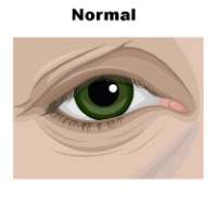 Figure Demonstrating Normal Eyelid Anatomy